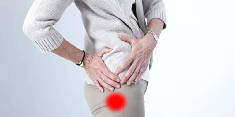 Trochanteritis: What is it and how does the pain go away?