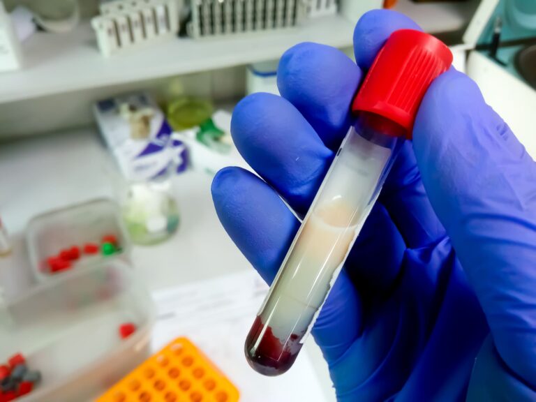 Triglycerides: why are they especially important in older people?